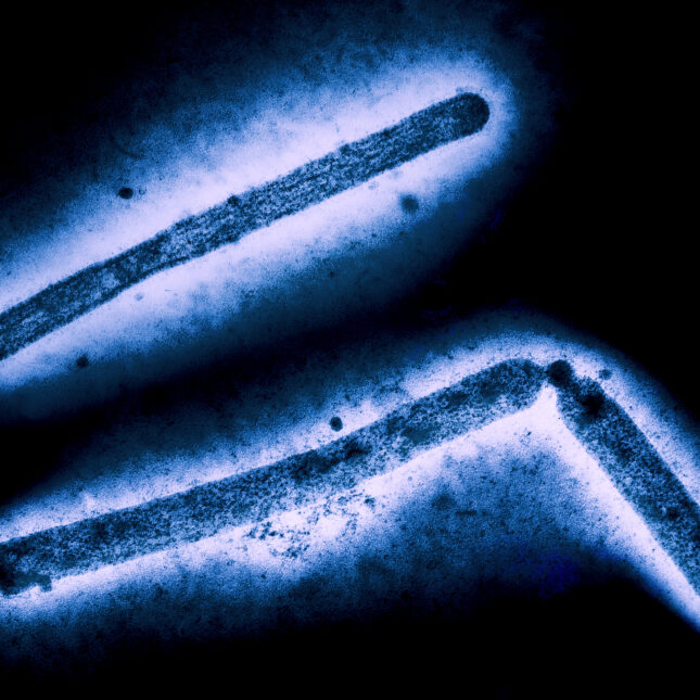 Influenza A Virus (H5N1/Bird Flu) Three influenza A (H5N1/bird flu) virus particles (rod-shaped). -- infectious disease coverage from stat