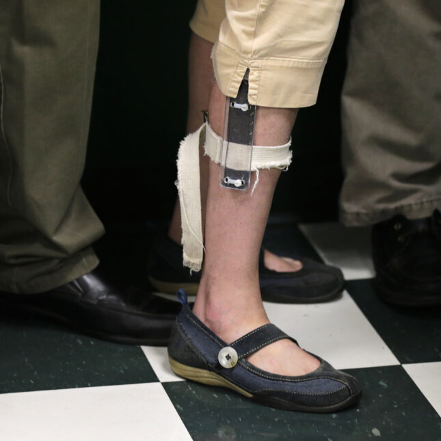 An electrical shock device is attached to a person's bare leg, as the line up in between two people wearing long pants -- coverage from STAT