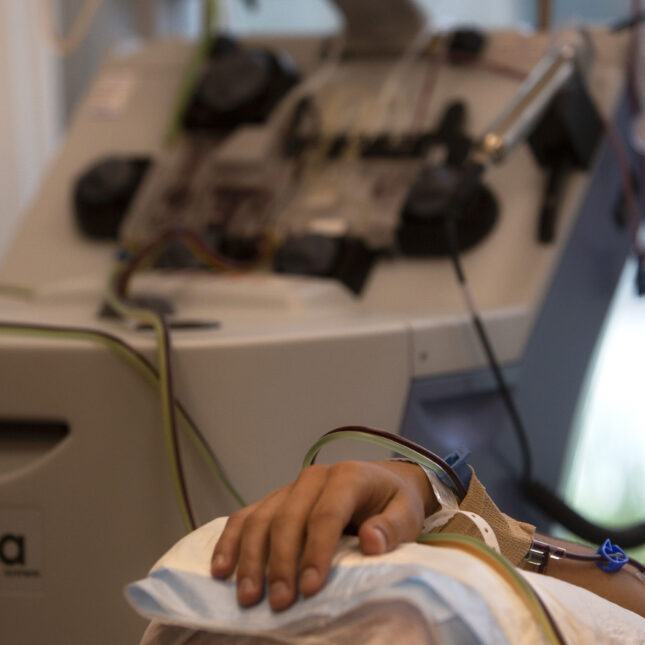 A person's hand, connected to thin tubes, rests on a pillow during a procedure for bone marrow donation -- health coverage from STAT